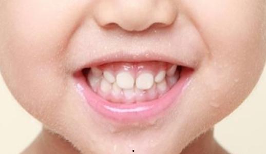 成人牙齿晃动视频教程,成人牙齿松动原因及改善方法解析