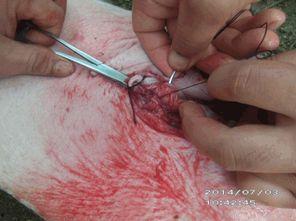 成人疝气如何修补视频教程,操作步骤与技巧解析